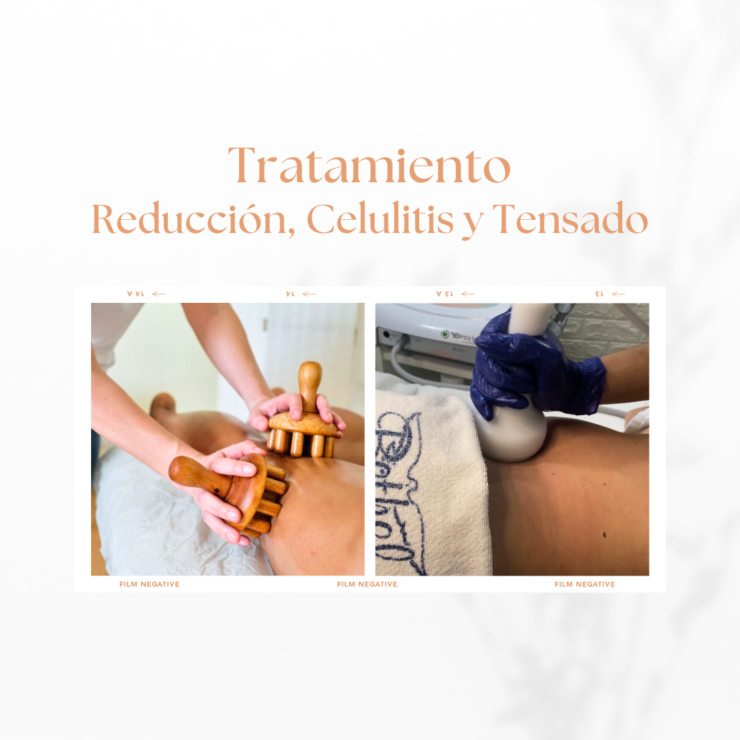 Tratamiento Reducción, Celulitis y Tensado | 10 sesiones